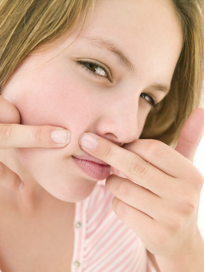 Teenage girl popping zit on face